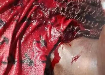 Drame amoureux à Sikensi : un jeune homme tente d’égorger sa copine après rupture